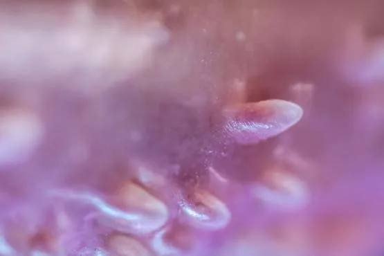HPV iyileşme süreci
