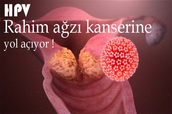 HPV ve rahim ağzı kanseri