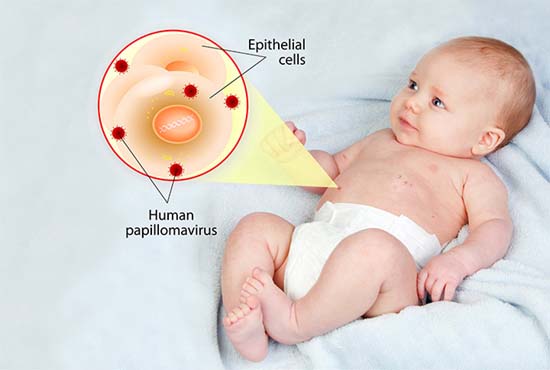 newborn hpv