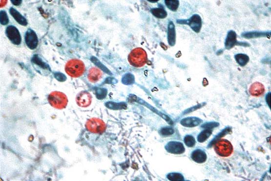 Si transmetohet HPV-ja